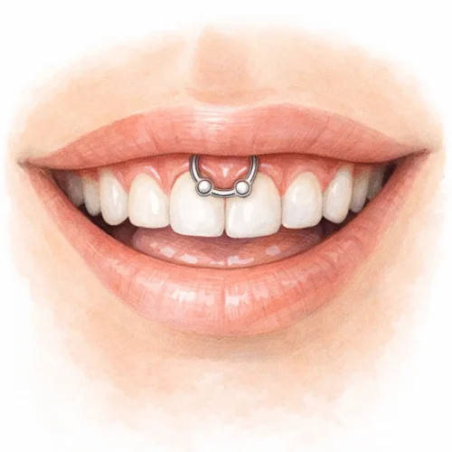 Smilley piercing